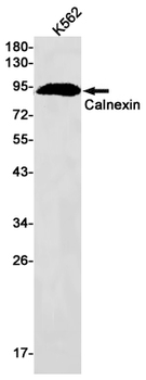 Calnexin Rabbit mAb Antibody