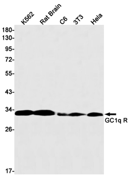 GC1q R Rabbit Monoclonal Antibody
