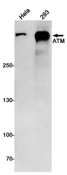 ATM Rabbit mAb Antibody