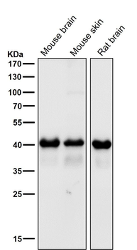 TDP 43 Rabbit mAb