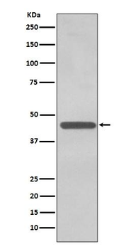 TDP 43 Rabbit mAb