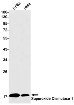Superoxide Dismutase 1 Rabbit mAb Antibody