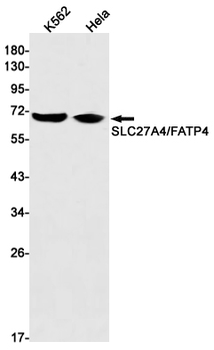 SLC27A4 Rabbit mAb