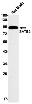 SATB2 Rabbit mAb Antibody
