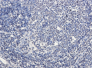 SATB1 Rabbit mAb Antibody
