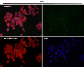Rad51 Rabbit mAb