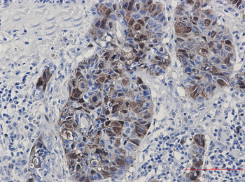 PBK Rabbit mAb Antibody