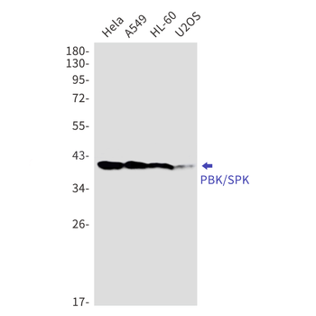 PBK Rabbit mAb Antibody