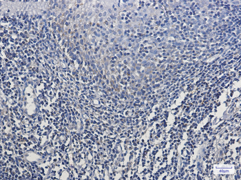 MTCO2 Rabbit mAb Antibody