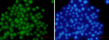 MSH6 Rabbit mAb Antibody
