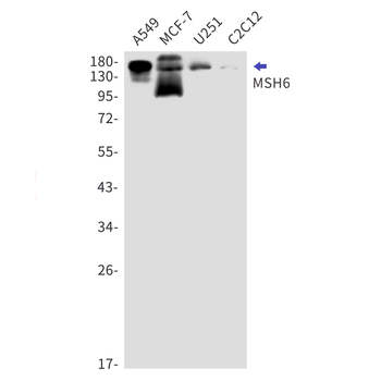 MSH6 Rabbit mAb Antibody