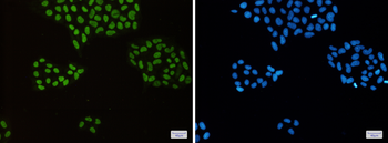 MCM2 Rabbit mAb Antibody