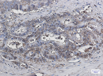Galectin 3 Rabbit mAb Antibody
