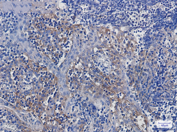 Integrin alpha V Rabbit mAb Antibody