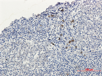 Human IgG4 Rabbit Monoclonal Antibody