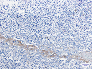 Glucose 6 Phosphate Dehydrogenase Rabbit Monoclonal Antibody