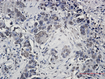 FUBP1 Rabbit mAb Antibody