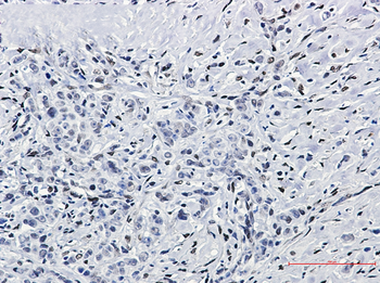 FTO Rabbit mAb Antibody
