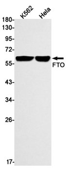 FTO Rabbit mAb Antibody