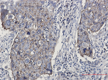 Junctional Adhesion Molecule 1 Rabbit mAb Antibody