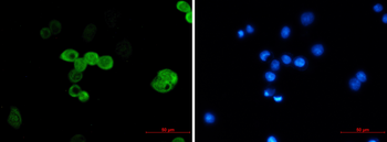 CRABP2 Rabbit mAb Antibody