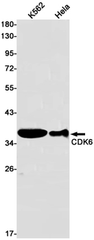 CDK6 Rabbit mAb Antibody