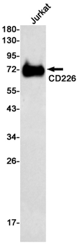 CD226 Rabbit mAb Antibody