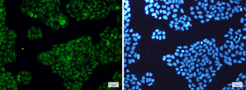 Calretinin Rabbit mAb Antibody
