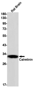 Calretinin Rabbit mAb Antibody