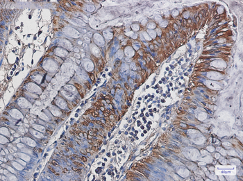 Carbonic Anhydrase 1 Rabbit mAb Antibody