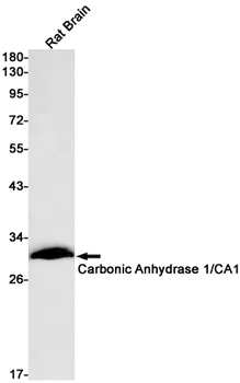 Carbonic Anhydrase 1 Rabbit mAb Antibody