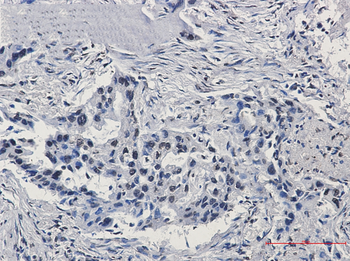 HIF1 beta Rabbit mAb Antibody
