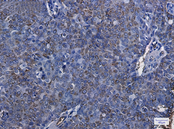 Aquaporin 1 Rabbit Monoclonal Antibody