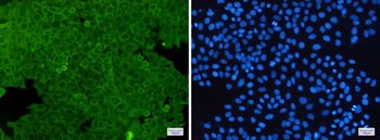 Annexin A2 Rabbit mAb Antibody