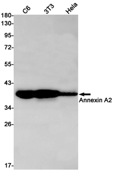 Annexin A2 Rabbit mAb Antibody