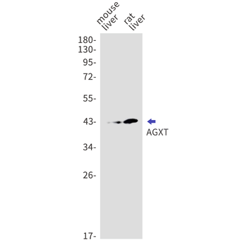AGXT Rabbit mAb Antibody