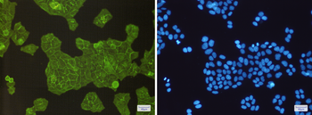 alpha Actinin 4 Rabbit mAb Antibody