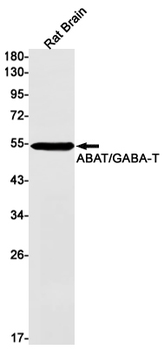 ABAT Rabbit mAb Antibody