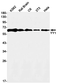 YY1 Rabbit mAb Antibody