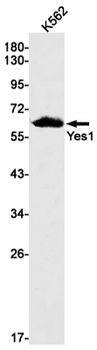 Yes1 Rabbit mAb Antibody