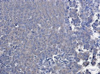 TXNDC9 Rabbit mAb Antibody
