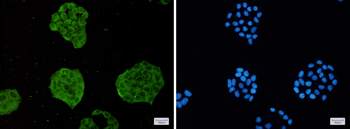 TRIM56 Rabbit mAb Antibody