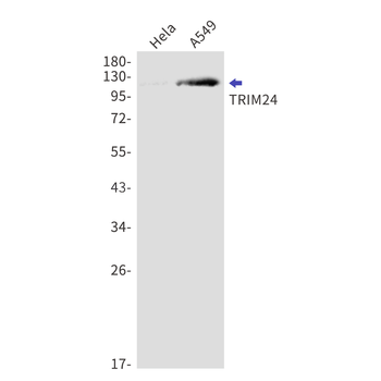 TRIM24 Rabbit mAb Antibody