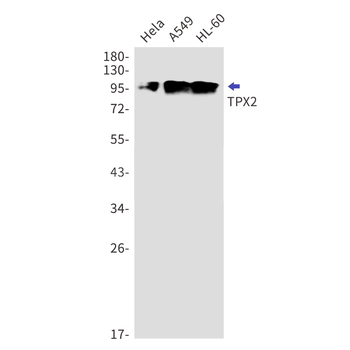 TPX2 Rabbit mAb Antibody