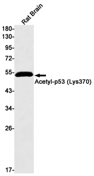 Acetyl-p53 (Lys370) Rabbit mAb Antibody