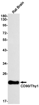 CD90 Rabbit mAb Antibody