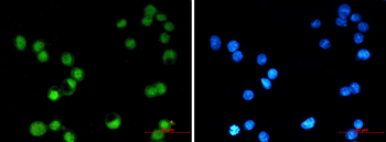Transcription Factor AP 2 gamma Rabbit mAb Antibody
