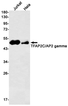Transcription Factor AP 2 gamma Rabbit mAb Antibody