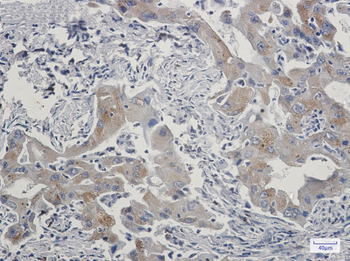 TAX1BP1 Rabbit Monoclonal Antibody
