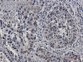 STAT4 Rabbit mAb Antibody